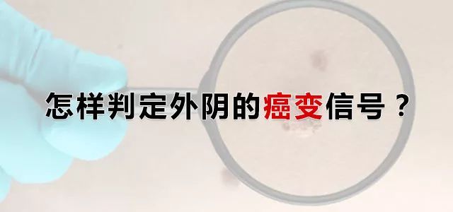 外阴白斑演变为外阴癌变都有哪几个信号?