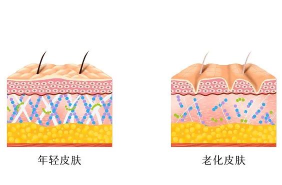 外阴白斑患者为什么还要戒糖?