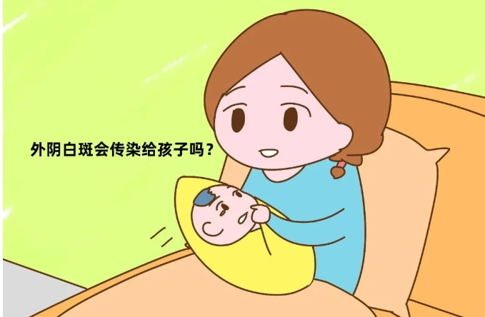 母女共同患上外阴白斑这是为什么？