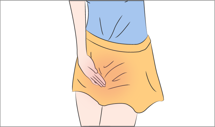 外阴白斑疾病为什么会使女性外阴产生裂口?