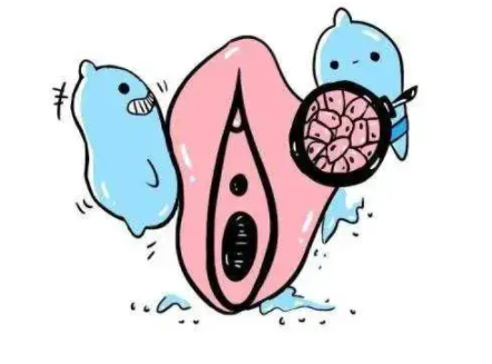 如何区分外阴白斑与阴道炎?