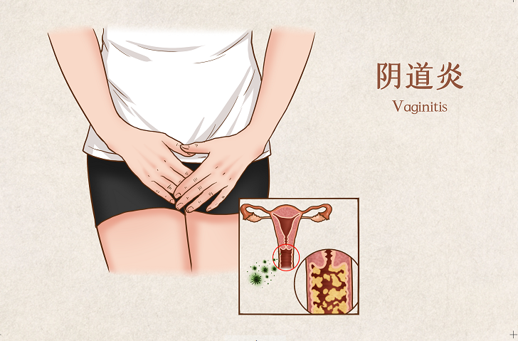 为什么初春时节私处就特别容易痒呢?