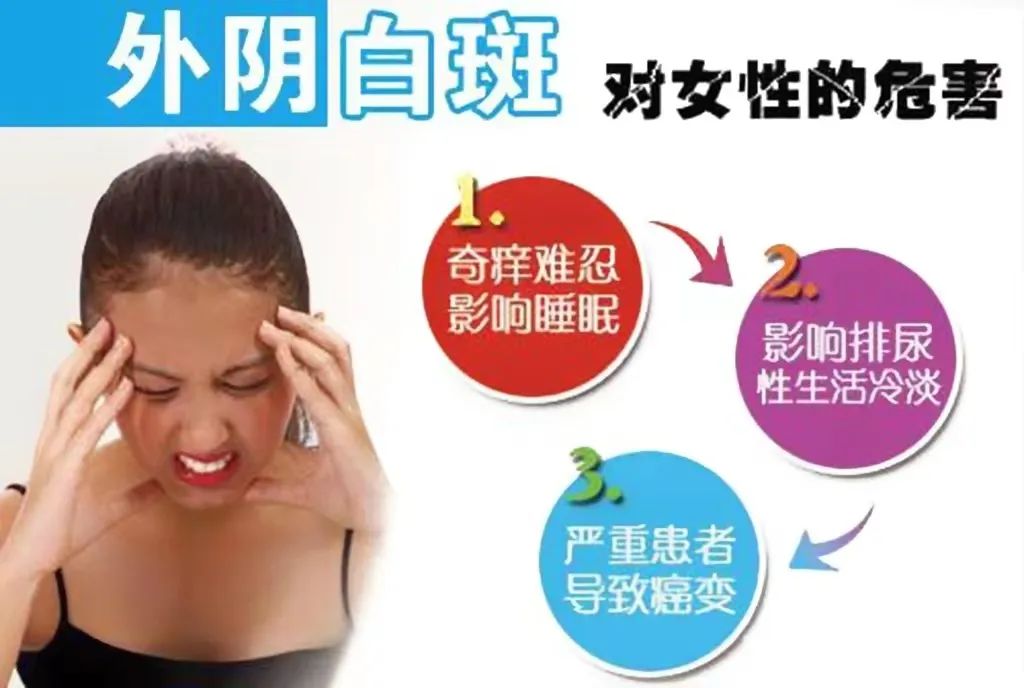 怎么防止外阴白斑扩散?